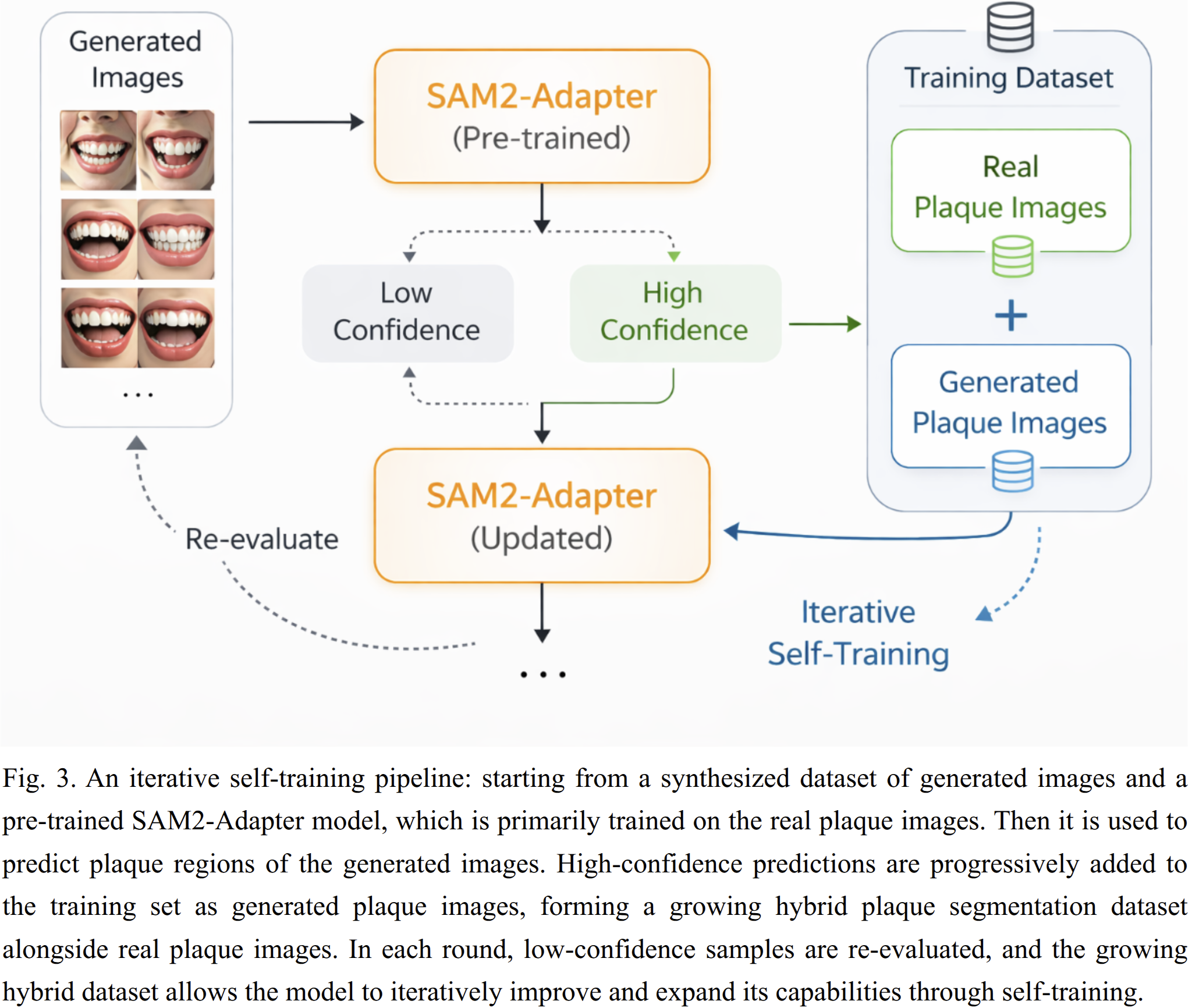 Automated Detection and Quantitative Assessment of Dental Plaque in Intraoral Images teaser